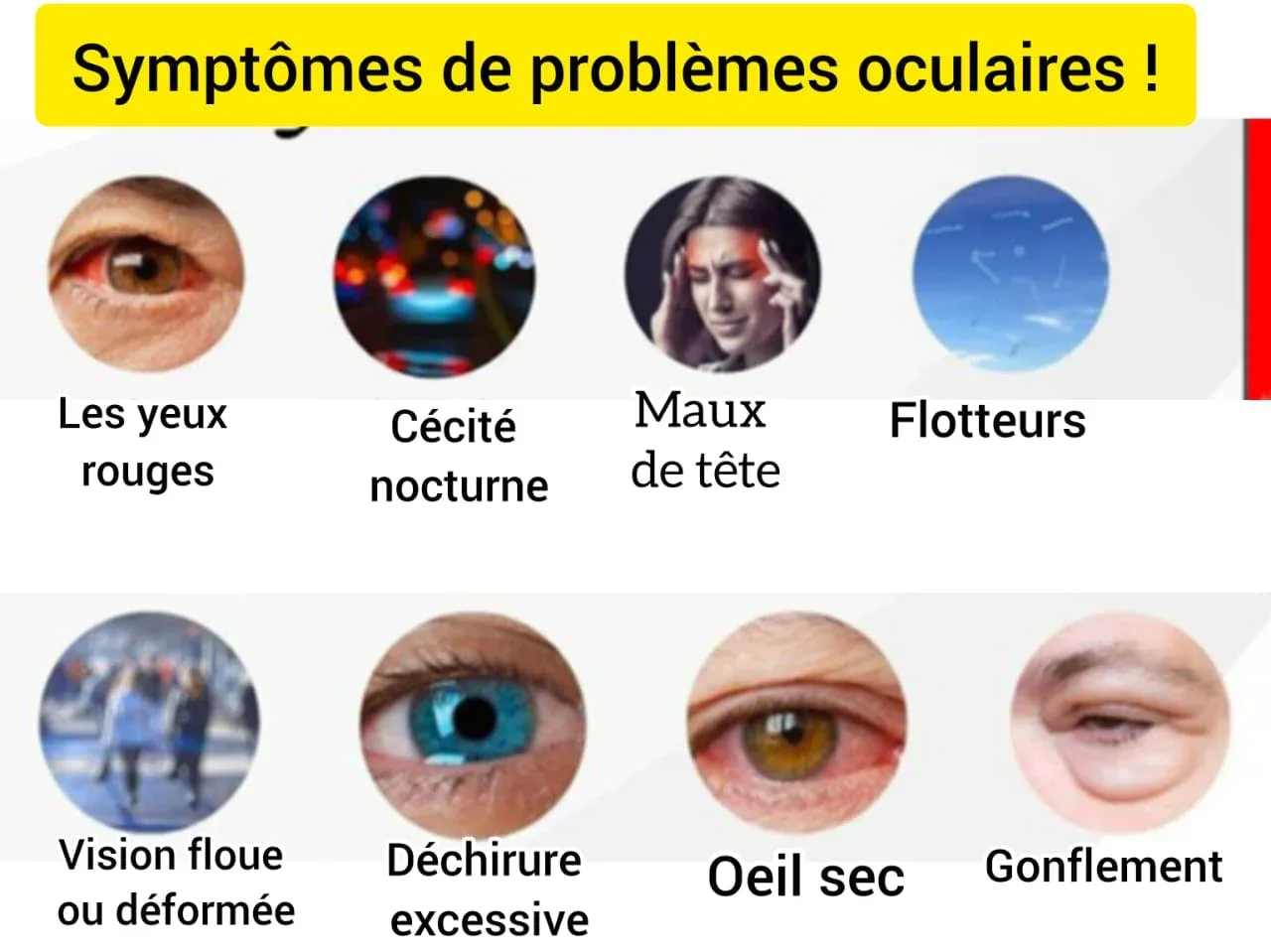 Traitement oculaire 11