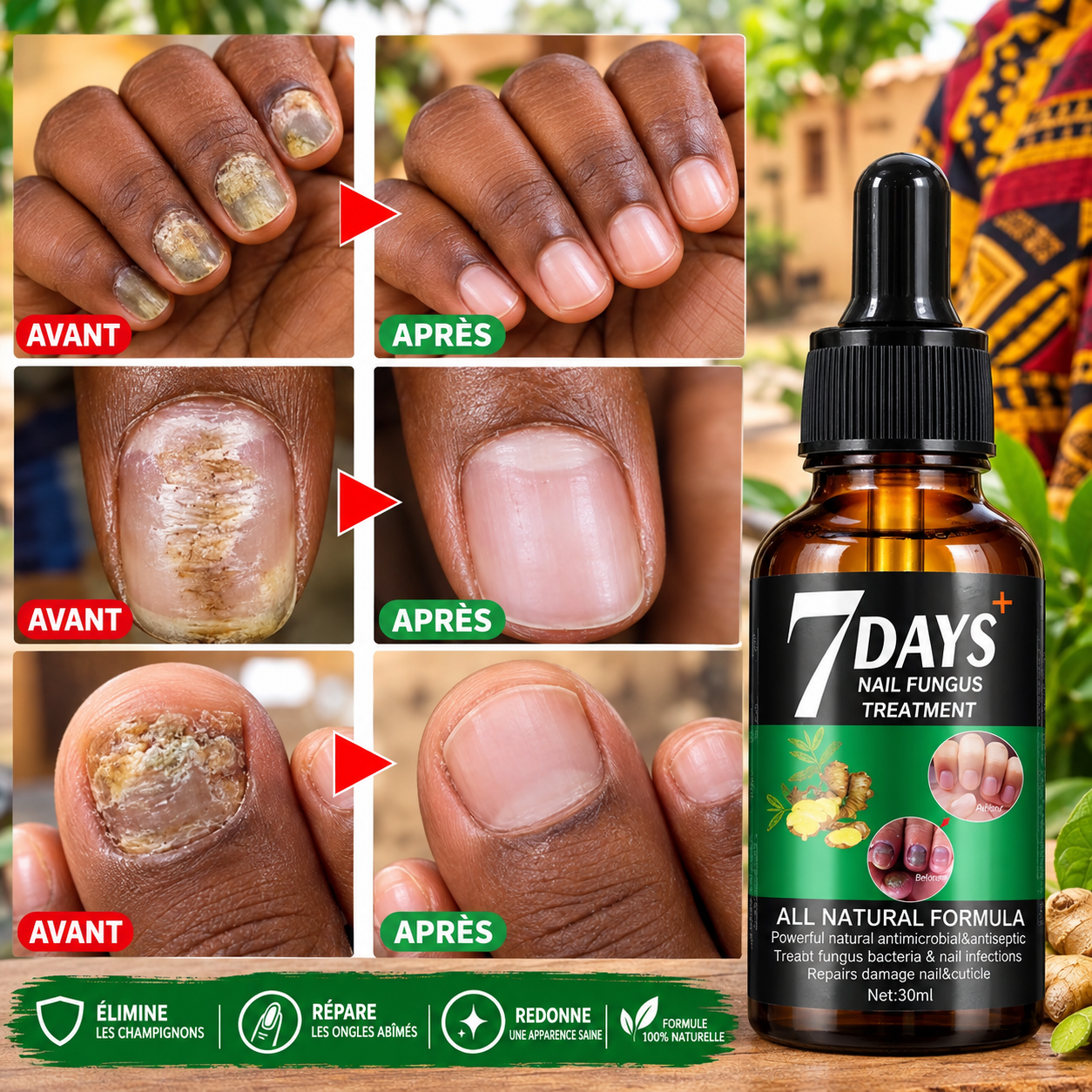 Pack Soin Complet des Pieds — Peaux mortes, Callosités & Ongles ternes 3