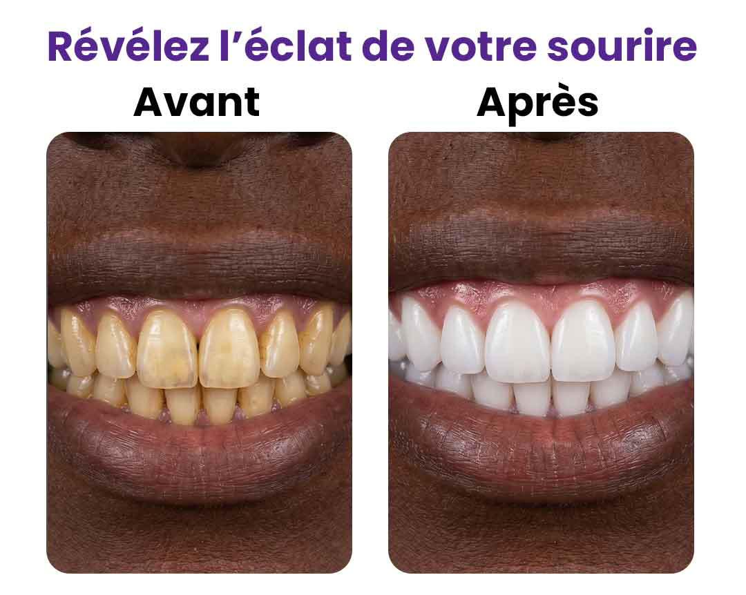 Bandes Blanchissantes Violettes pour les Dents 5