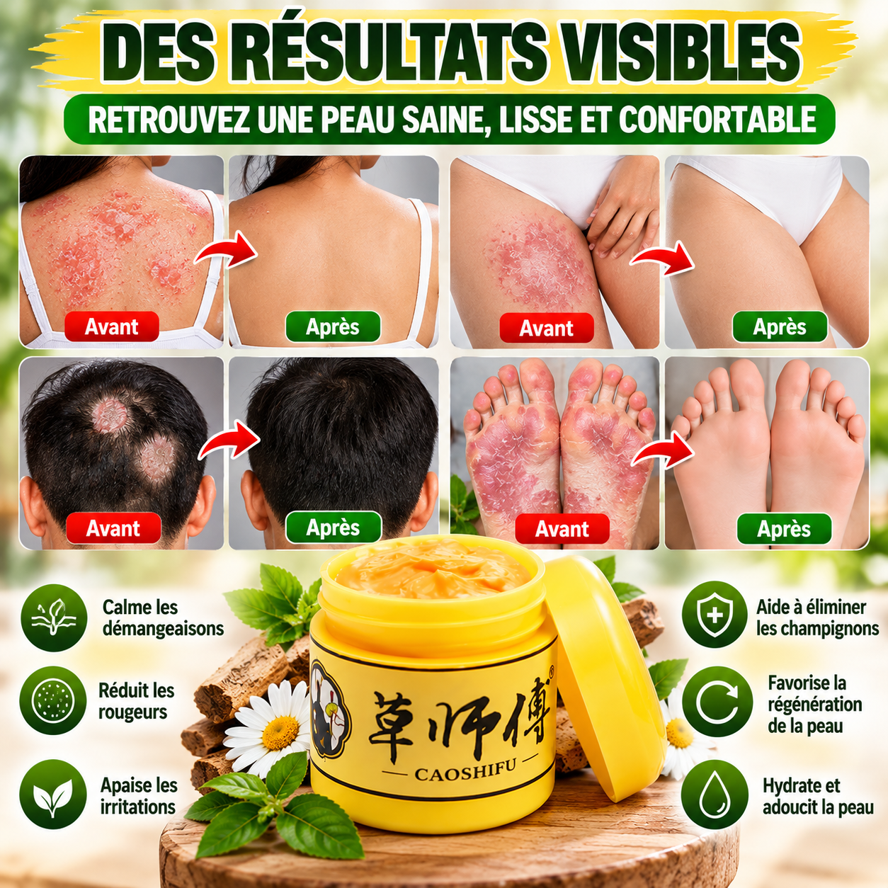 Crème CAOSHIFU – Soin des peaux sujettes aux démangeaisons et aux rougeurs