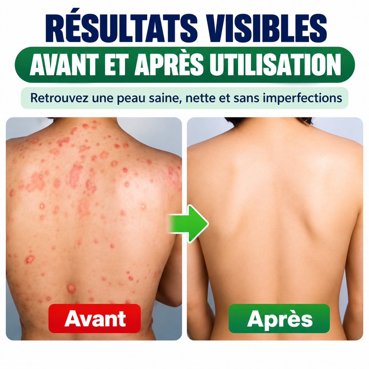Crème CAOSHIFU – Soin des peaux sujettes aux démangeaisons et aux rougeurs 4