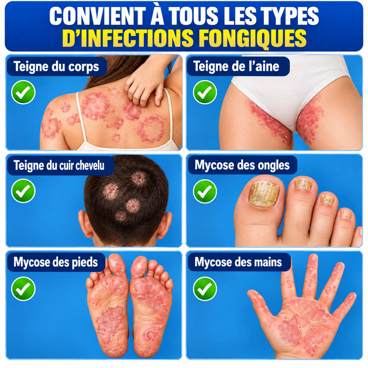 Crème CAOSHIFU – Soin des peaux sujettes aux démangeaisons et aux rougeurs 2